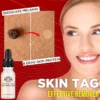 TagGone™ Natural Tags Serum