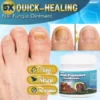 Aexzr™ 5X Quick-healing Nail Fungus Ointment